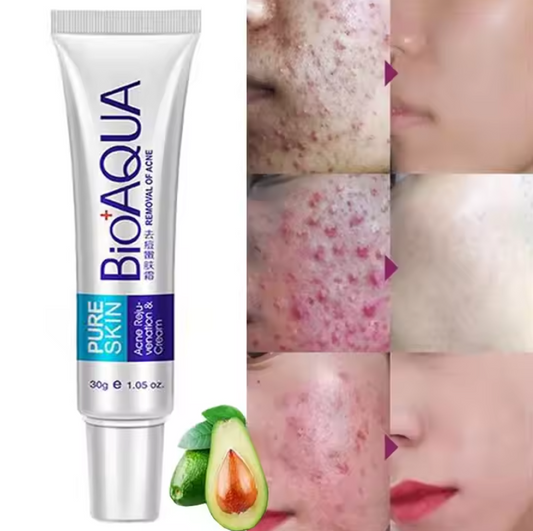 BIOAQUA Acne Removal Day Cream-FlyingCart.pk