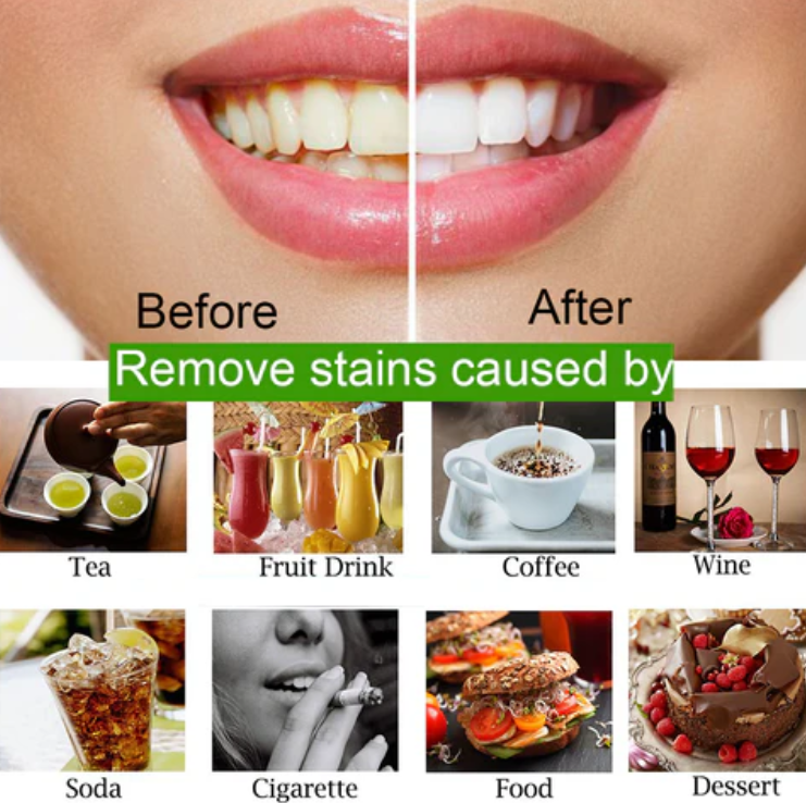Mad Smile Teeth Cleaning Powder (organic) White (30g)-FlyingCart.pk