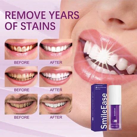 Teeth Brightening Hismiles V34 Colour Corrector Serum - Flyingcart.pk