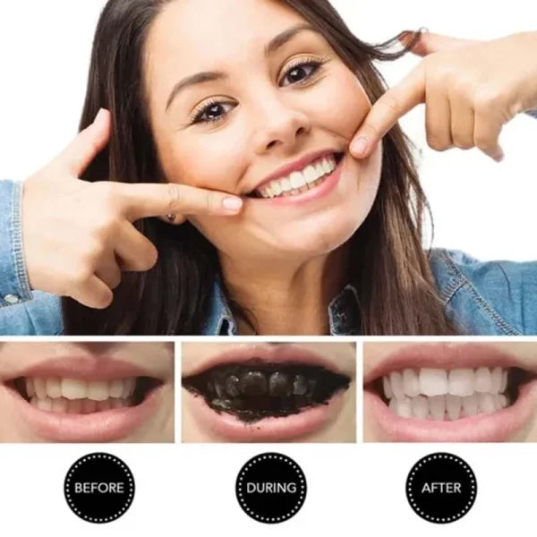 teeth-whitening-charcoal-powder-organic-charcoal-30g-1_1-Flyingcart.pk