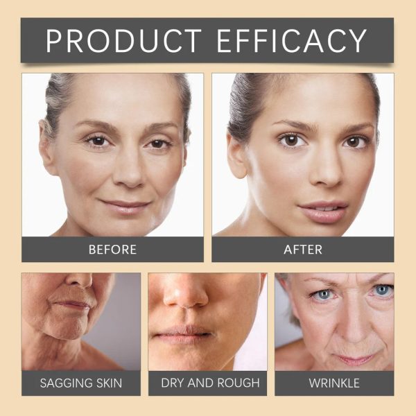 whitening-moisturizing-bee-venom-facial-care-cream-brightening-anti-aging-hydrating-face-moisturizer-for-radiant-smooth-youthful-skin-1-flyingcart.pk