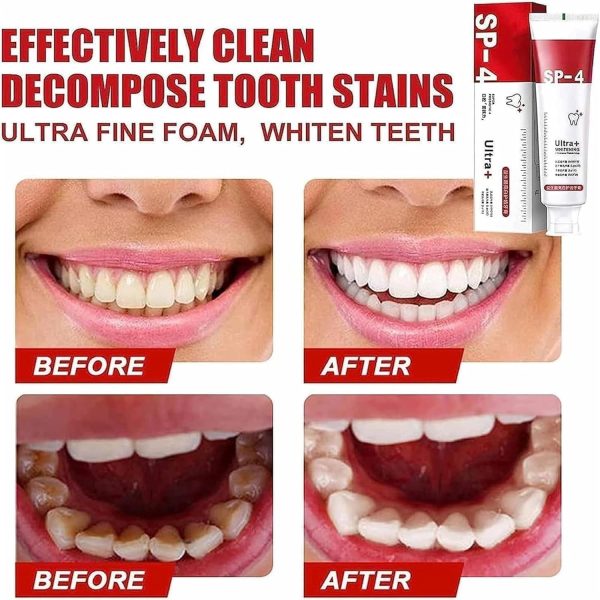 Yayashi SP-4 Ultra Whitening Toothpaste – Probiotic Stain Remover (120g) - Flyingcart.pk