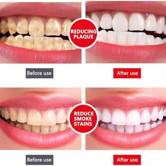 Yayashi SP-4 Ultra Whitening Toothpaste – Probiotic Stain Remover (120g) - Flyingcart.pk