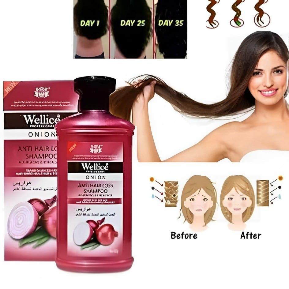 Wellice Onion Anti Hair Loss Shampoo-FlyingCart.pk