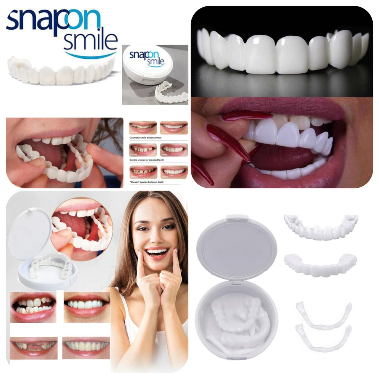  Natural Cosmetic Dental Fake Tooth Covers-FlyingCart.pk