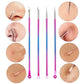 Blackhead Acne Espinillas Pimple Remover Tool 4 Pcs - FlyingCart.pk