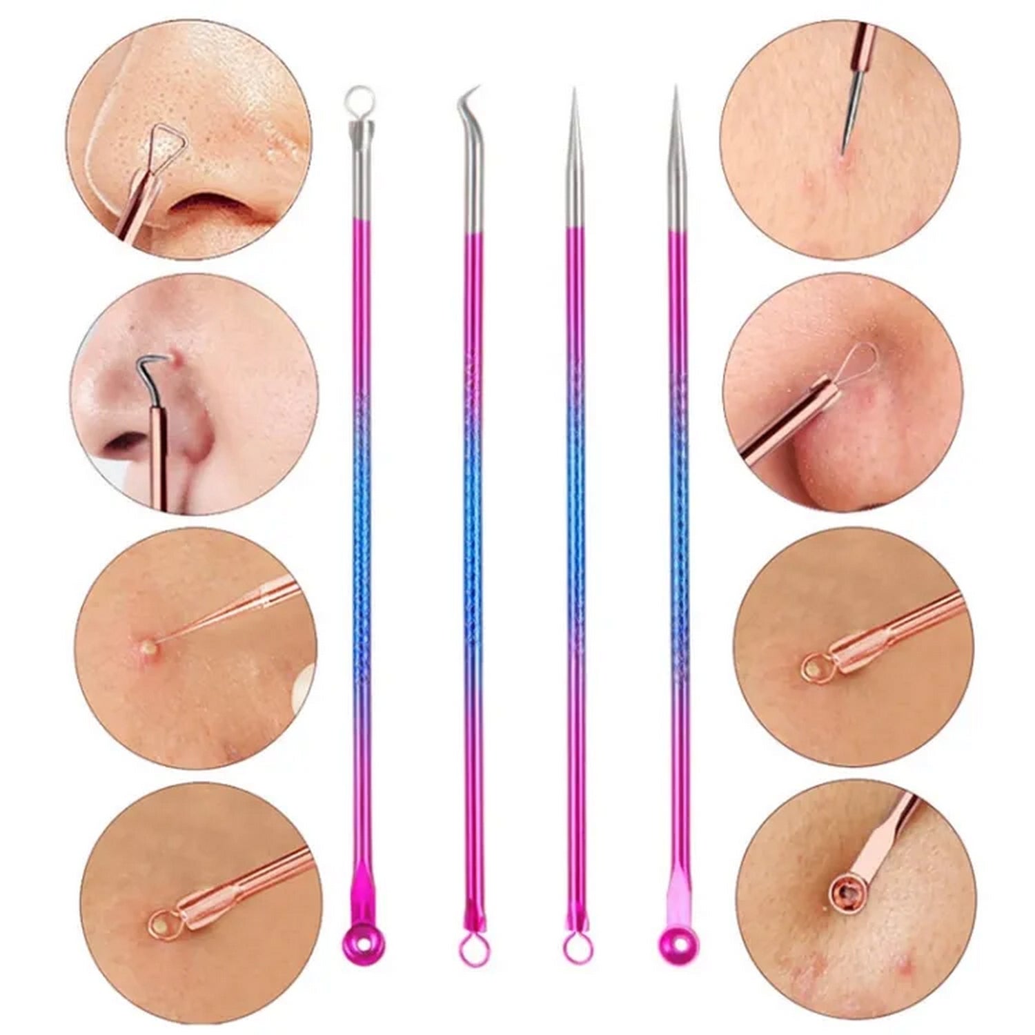 Blackhead Acne Espinillas Pimple Remover Tool 4 Pcs - FlyingCart.pk