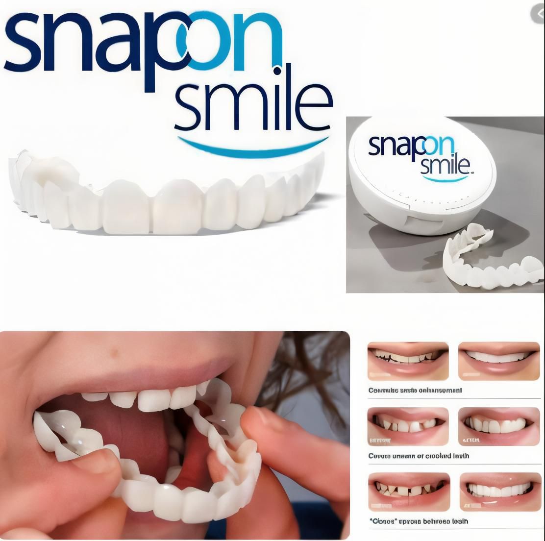 Snapon Teeth for Men and Women-FlyingCart.pk