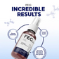 feg-plus-beard-hair-growth-serum-spray-powered-by-nature-for-visible-results-best-quality-hair-growth-spray-hair-serum-60-ml-2-3-flyingcart.pk