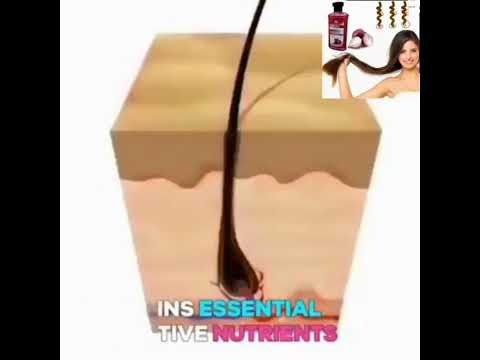 Wellice Onion Anti Hair Loss Shampoo-FlyingCart.pk