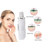 rechargeable-ultrasonic-skin-scrubber-deep-cleansing-facial-spatula-blackhead-remover-with-vibration-peeling-modes-1-flyincart.pk