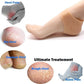 Silicone Anti-crack Half Heel Socks Set - Flyingcart.pk