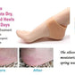 Silicone Anti-crack Half Heel Socks Set - Flyingcart.pk