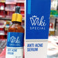 wiki-special-anti-acne-serum-30ml-clears-acne-soothes-skin-fights-blemishes-5-flyingcart.pk